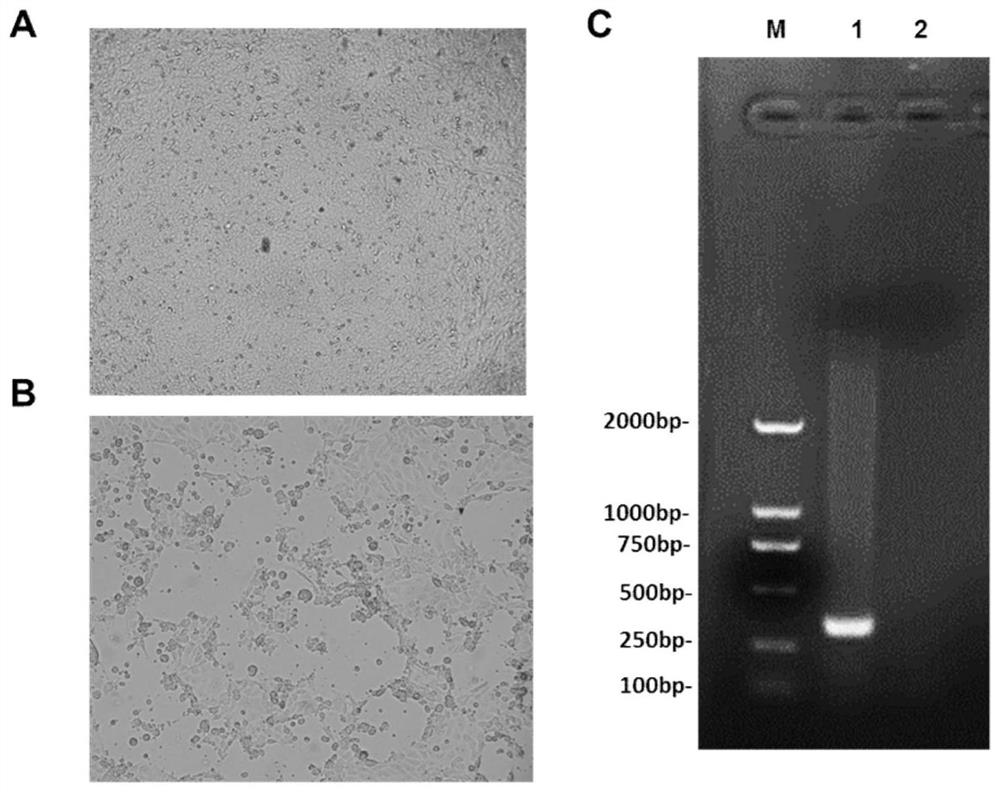 Porcine epidemic diarrhea, porcine delta coronavirus dual attenuated vaccine and preparation method thereof