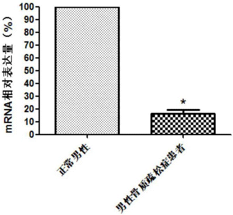 GM2A genes as marker of male osteoporosis diagnosis and prognosis