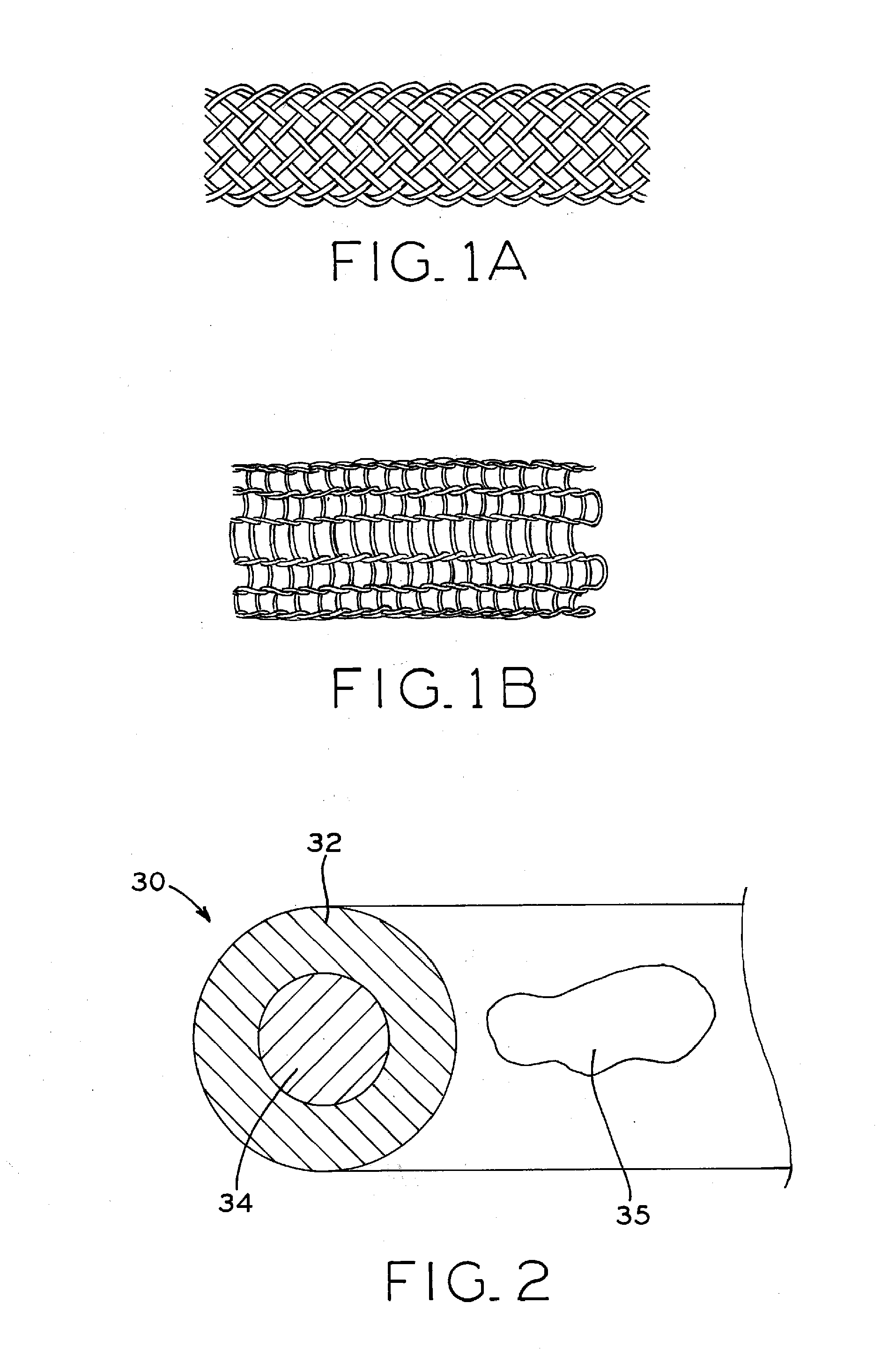 Biodegradable composite wire for medical devices