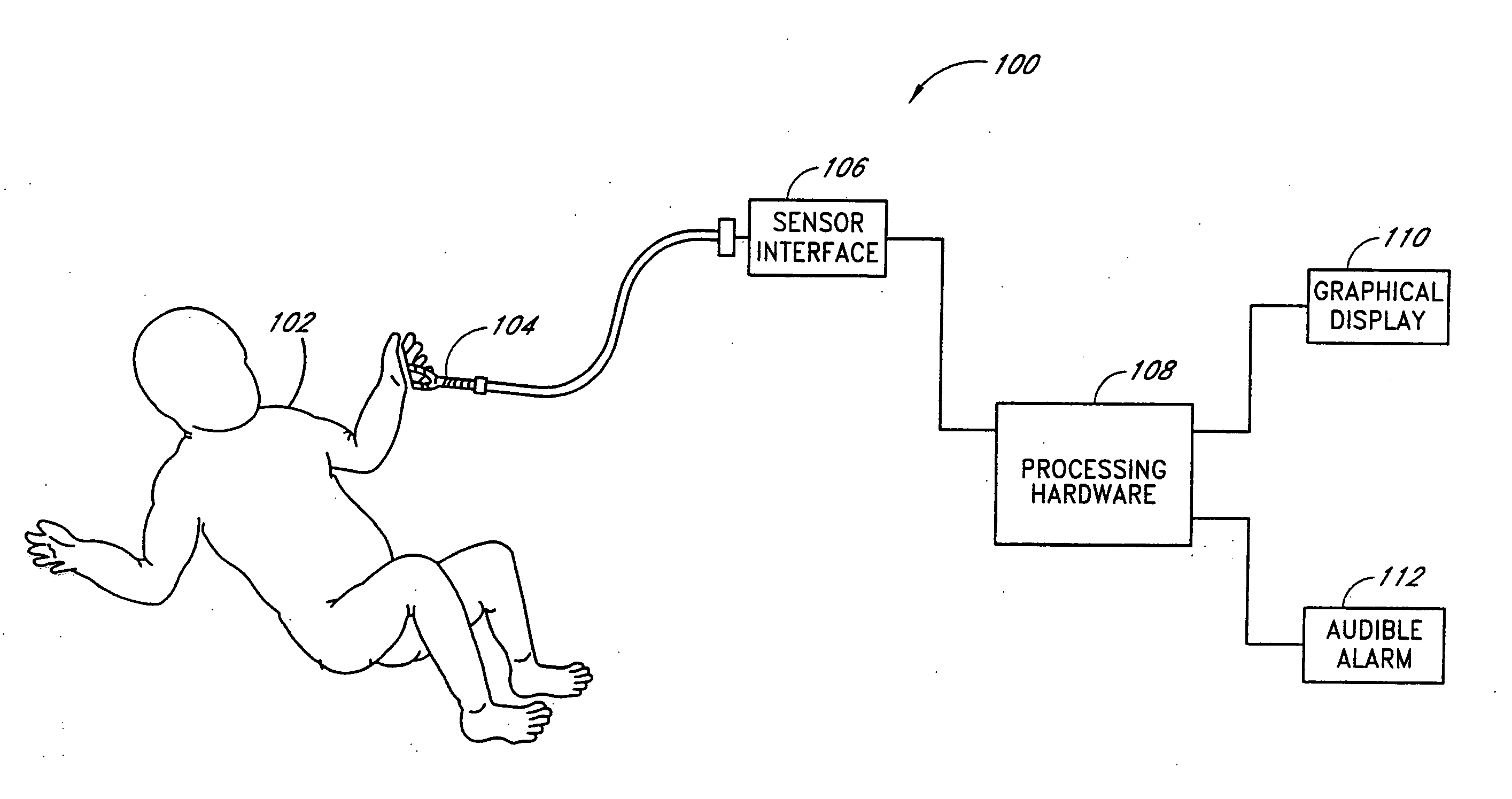 Apnea detection system