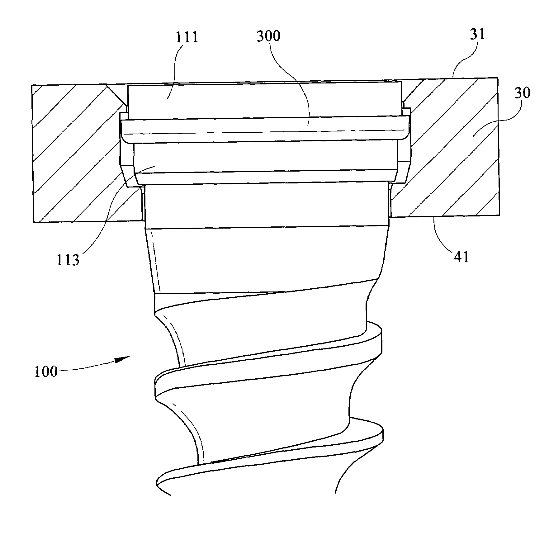 Fixed and variable locking fixation assembly