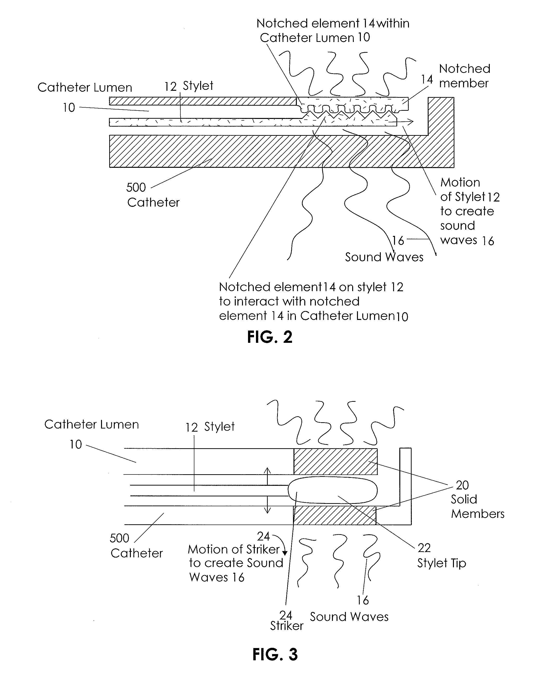 Apparatus and Method for Vascular Access