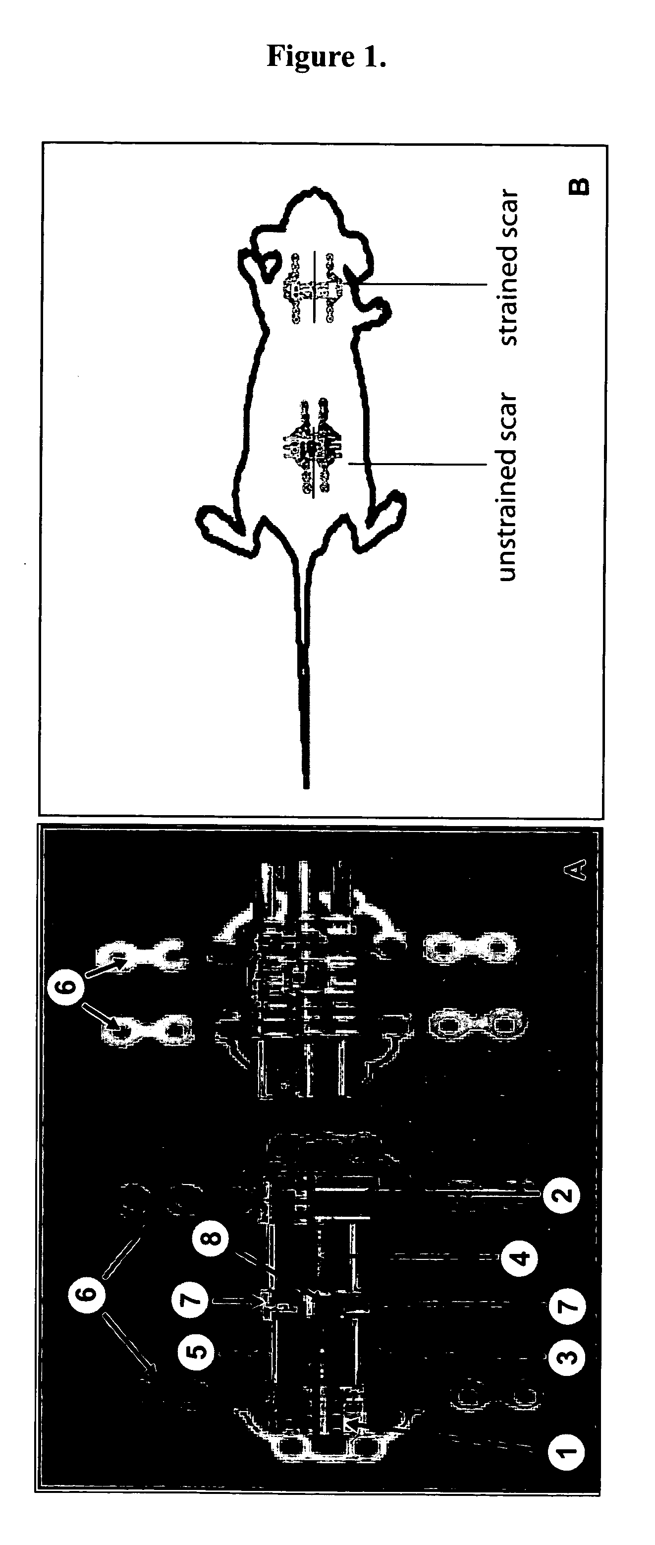 Method for producing hypertrophic scarring animal model for identification of agents for prevention and treatment of human hypertrophic scarring