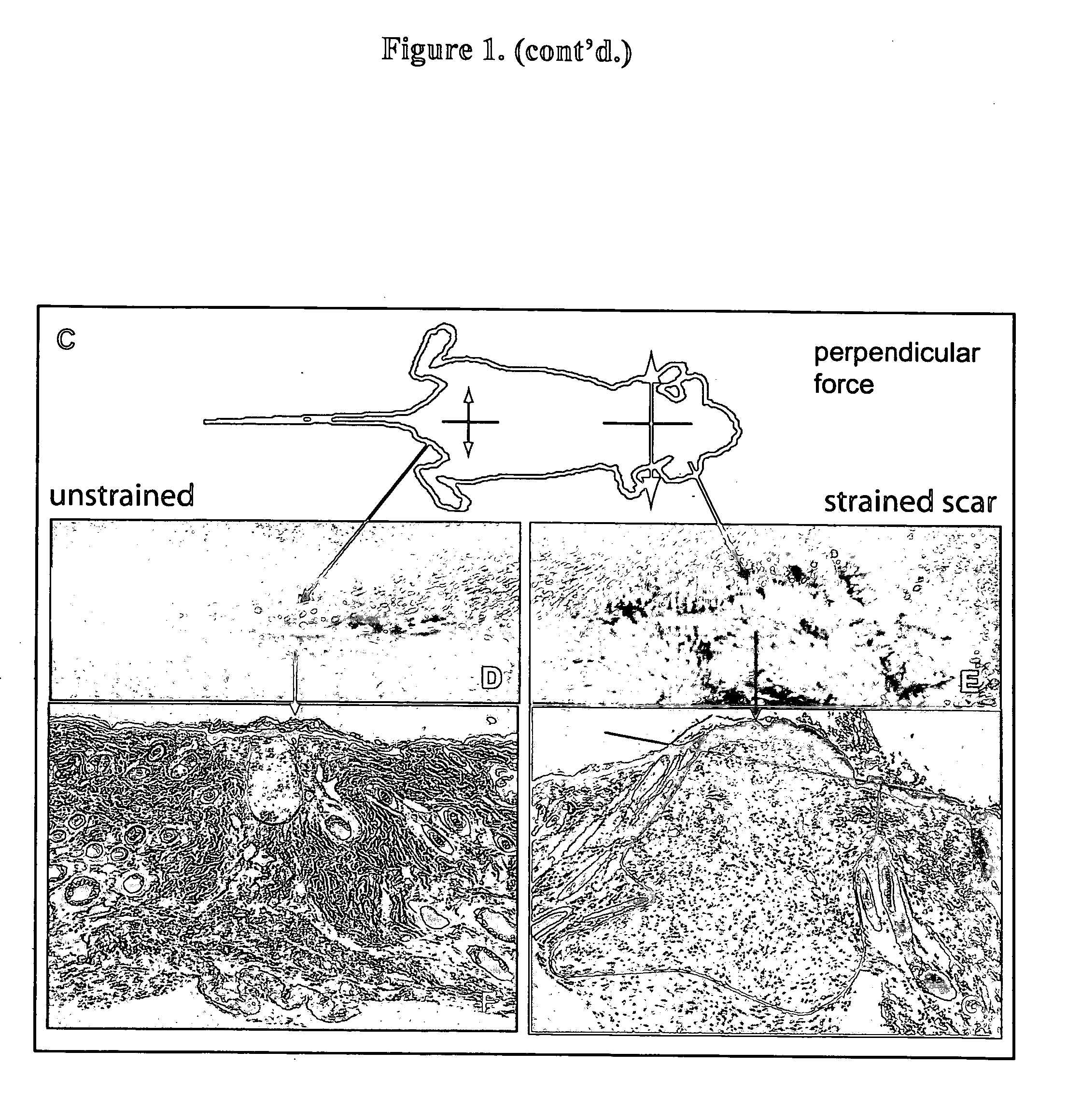 Method for producing hypertrophic scarring animal model for identification of agents for prevention and treatment of human hypertrophic scarring