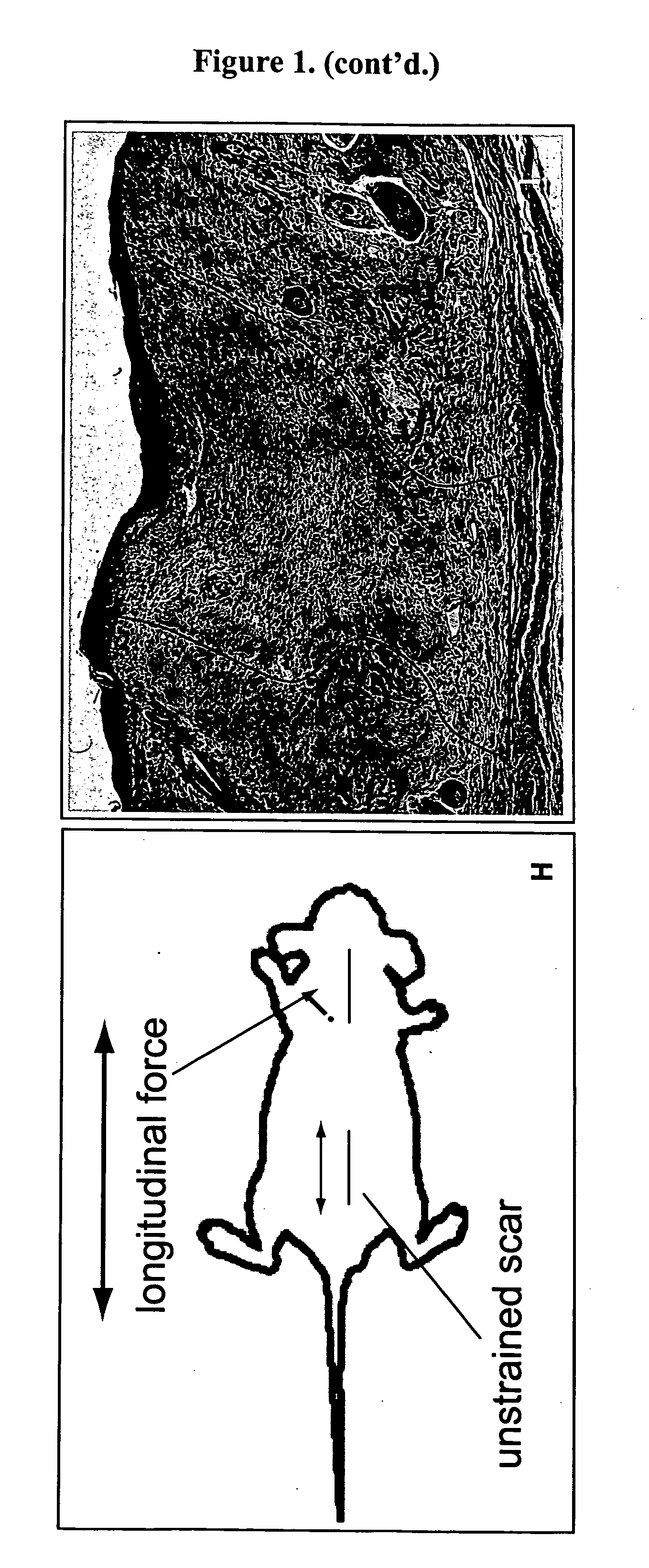 Method for producing hypertrophic scarring animal model for identification of agents for prevention and treatment of human hypertrophic scarring