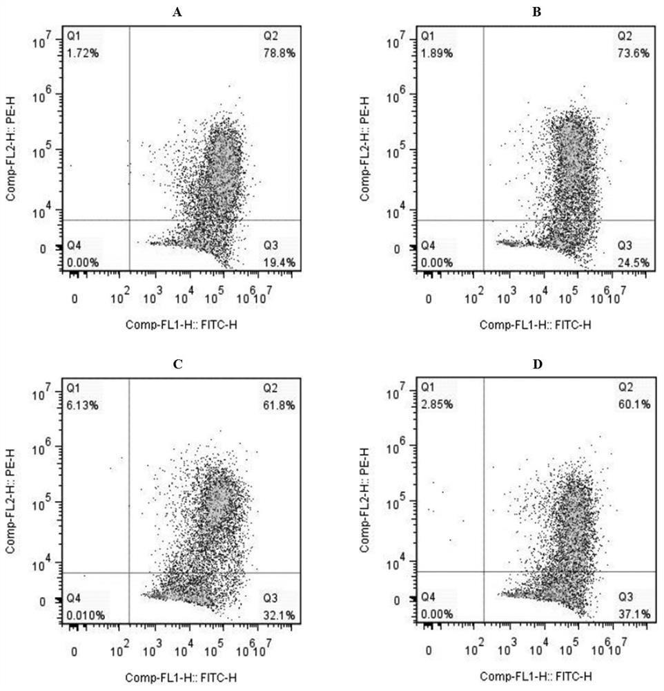 Application of lauric acid in preparation of hepatic tumor resisting preparation