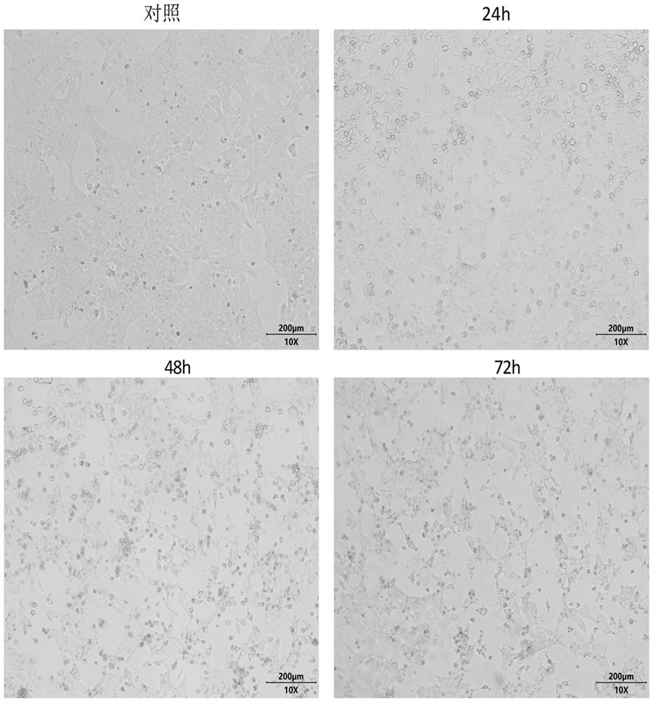 Application of lauric acid in preparation of hepatic tumor resisting preparation