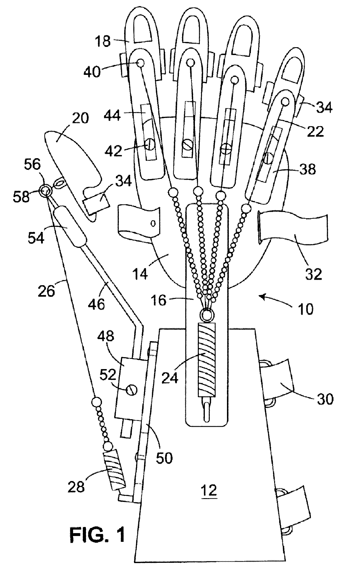 Dynamic hand splint