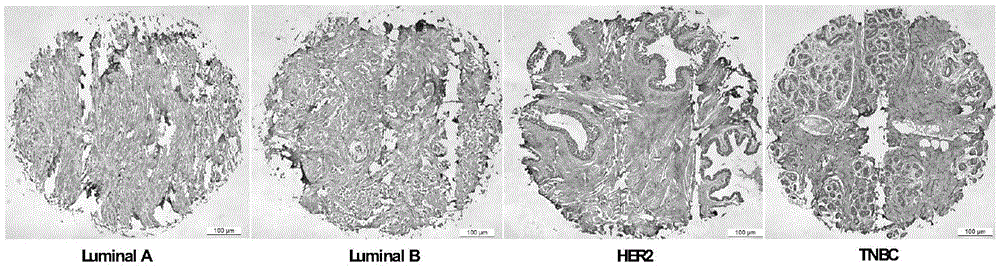 TGF beta2 gene, TGF beta 2 polypeptide and application thereof