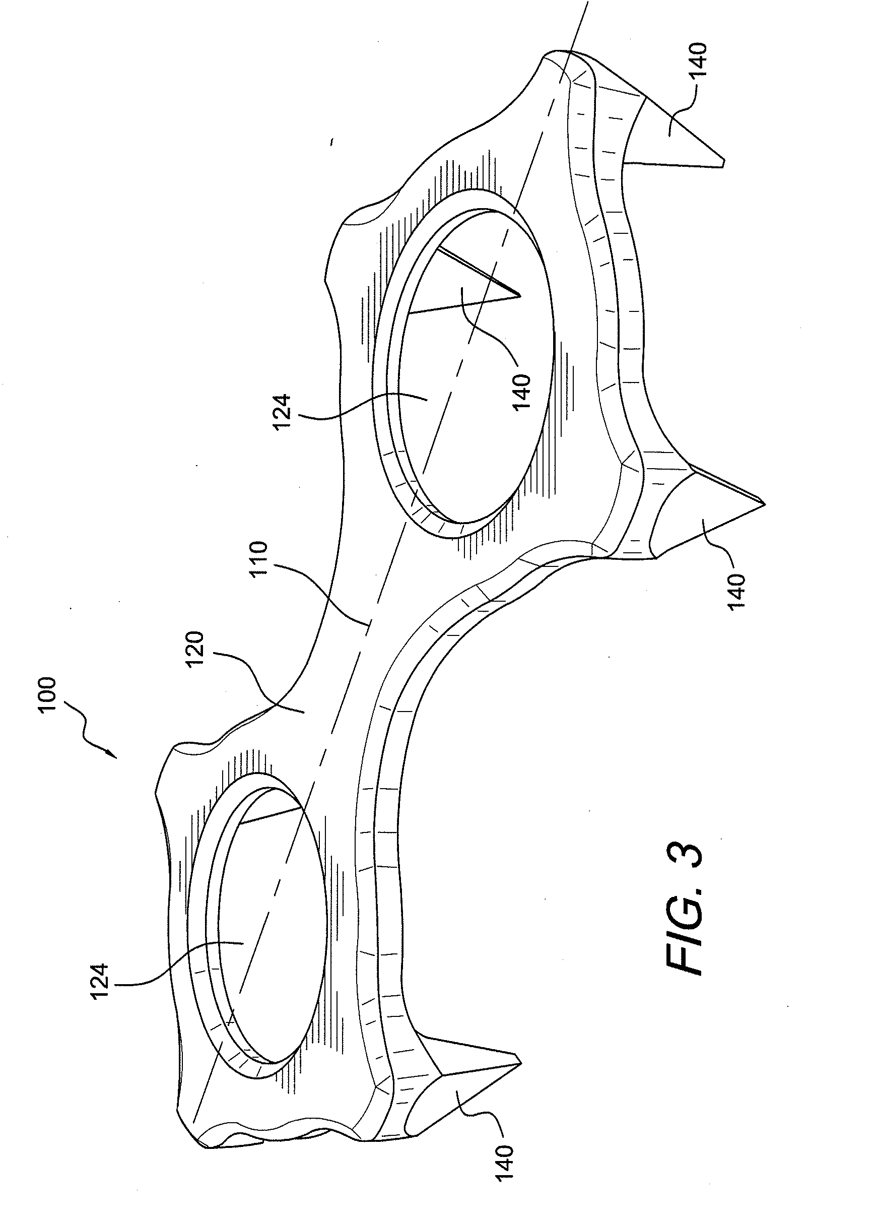 Wedged profile plate