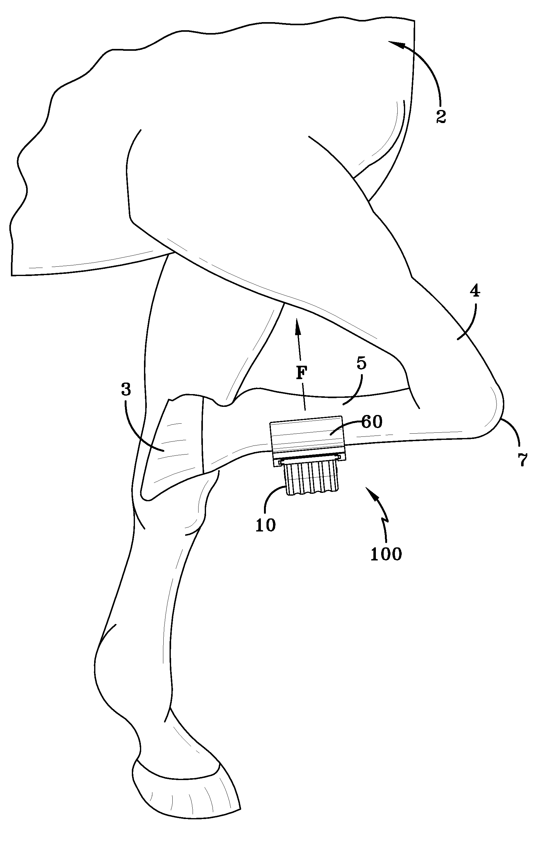 Equine locomotor flexion algometry device (ELFA)