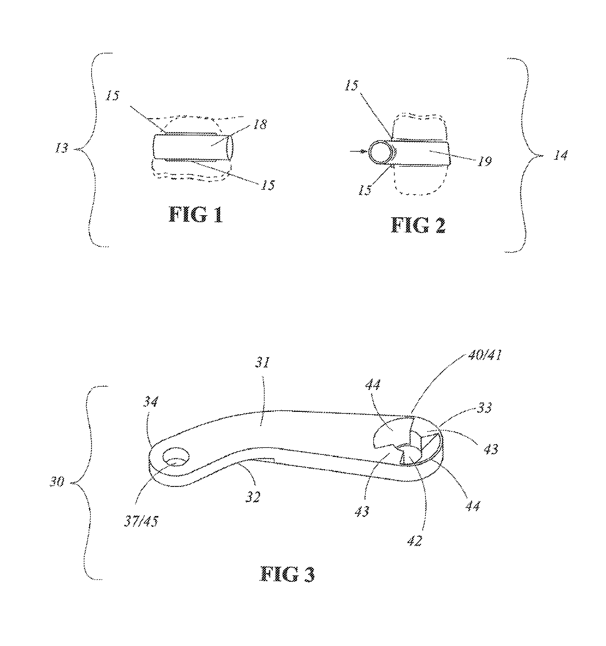 Dental occlusion correcting system