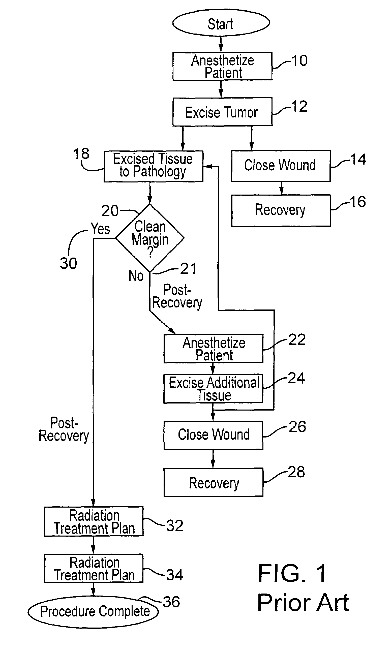 Method for radiation treatment