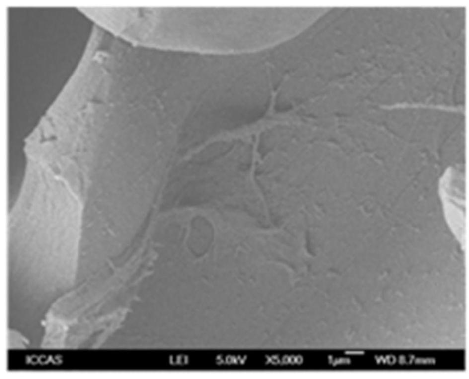 Preparation method of a double-layer composite scaffold for inducing pulp dentin tissue regeneration