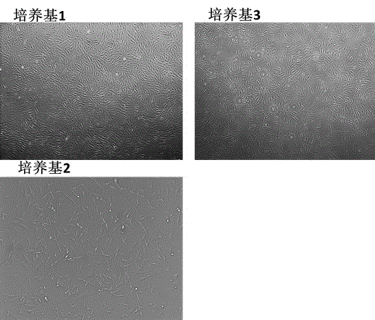 Serum-free medium for human umbilical cord mesenchymal stem cells and preparation method thereof