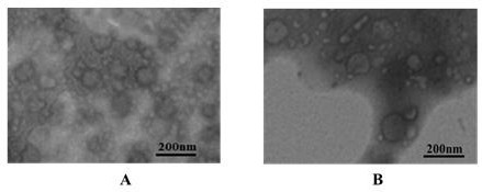 Non-coding RNA expression profile analysis method for echinococcus granulosus protoscolex derived exosomes and cyst fluid derived exosomes and non-coding RNA sequences