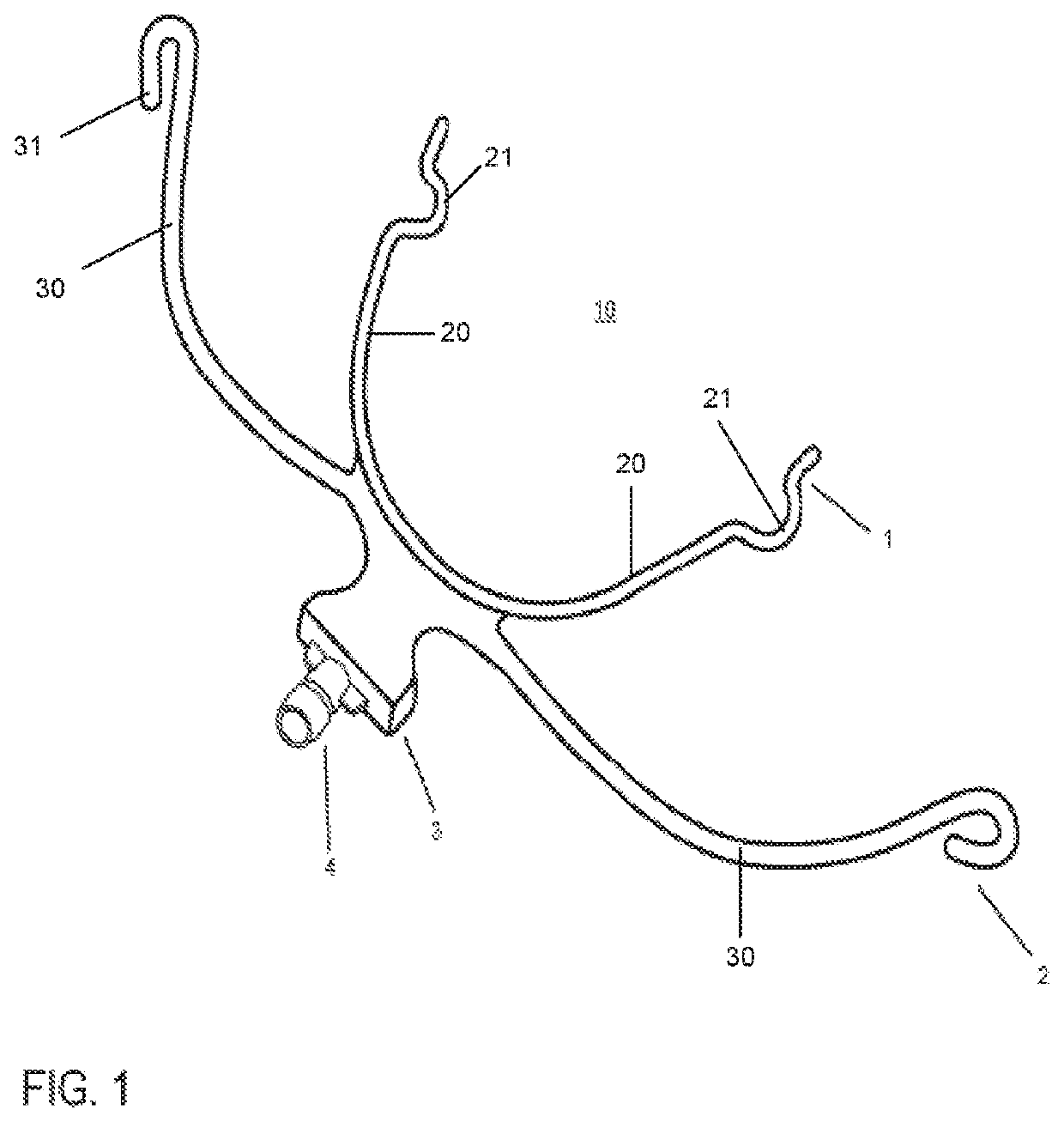 System and method of more directly vibrating an orthopedic-orthodontic device