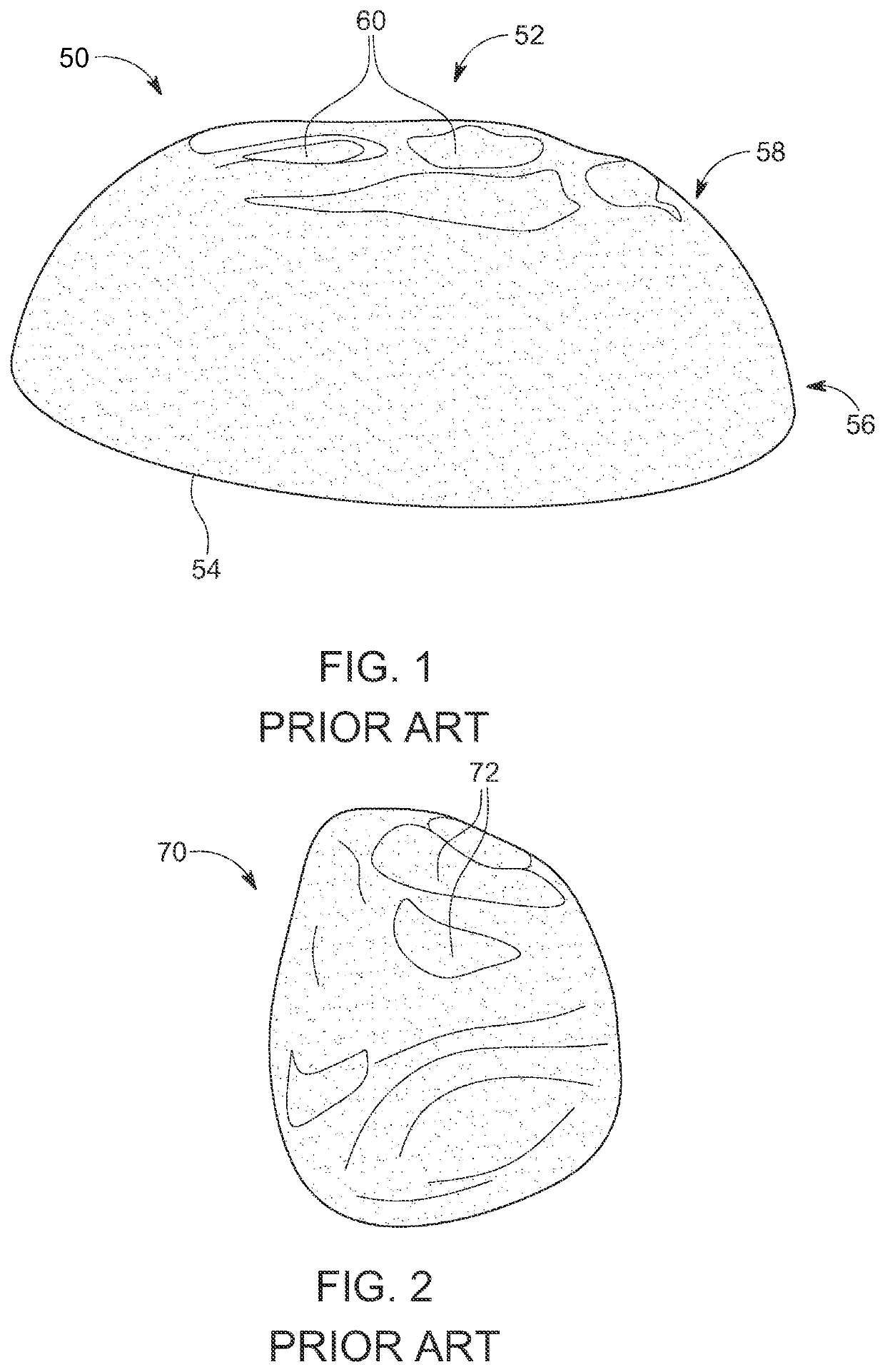 Systems, devices and methods of making mammary implants and tissue expanders having ribbed shells