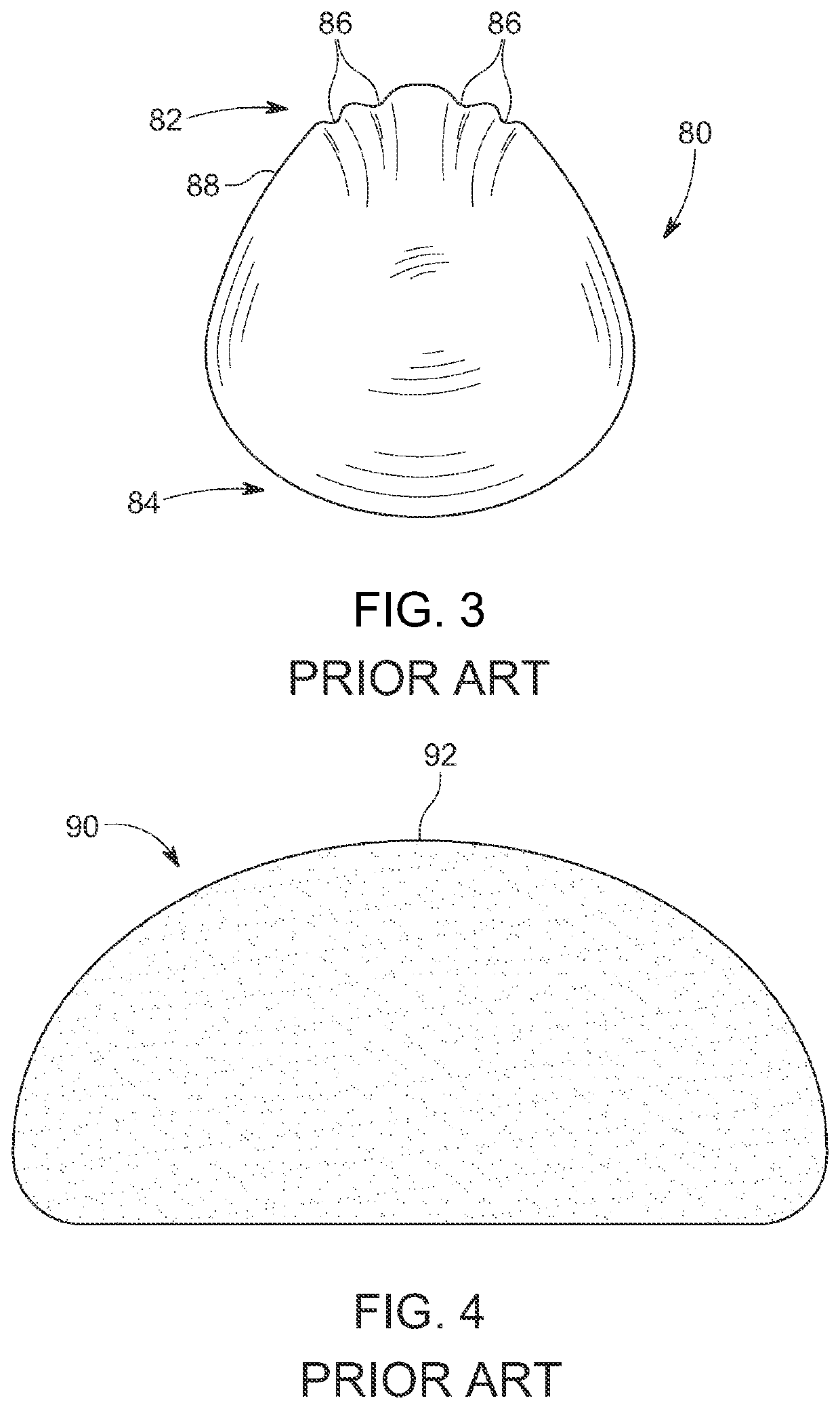 Systems, devices and methods of making mammary implants and tissue expanders having ribbed shells