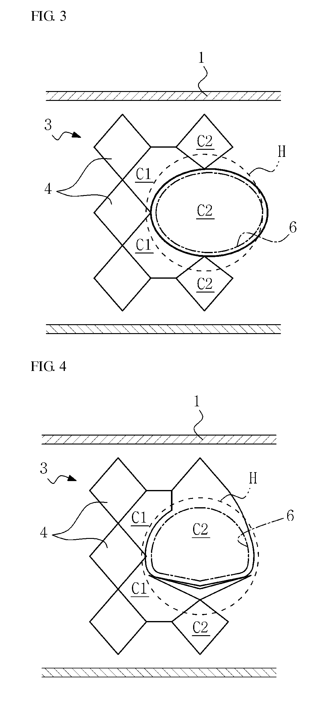 Stent for protecting bifurcated blood vessels in bifurcation lesion