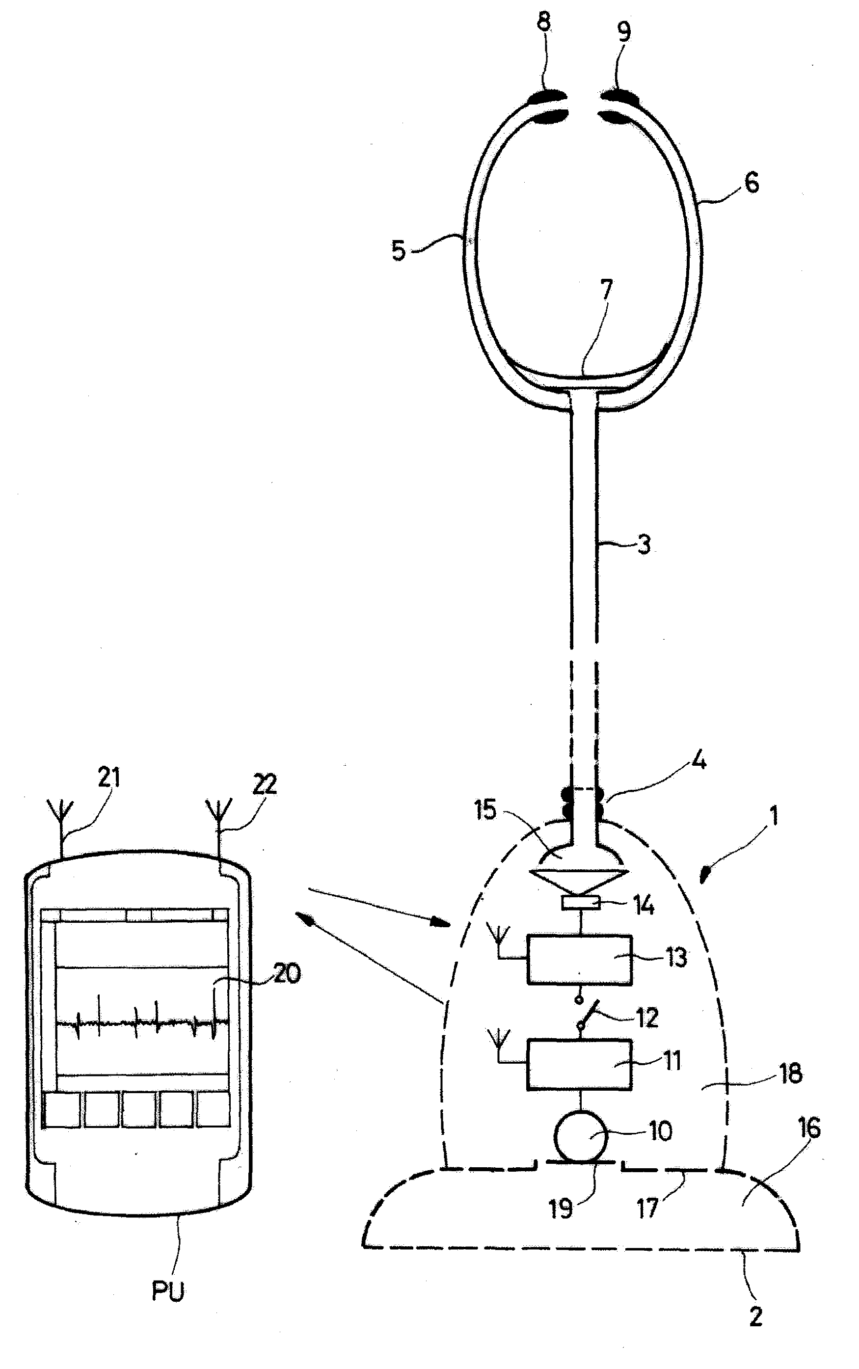 Electronic stethoscope