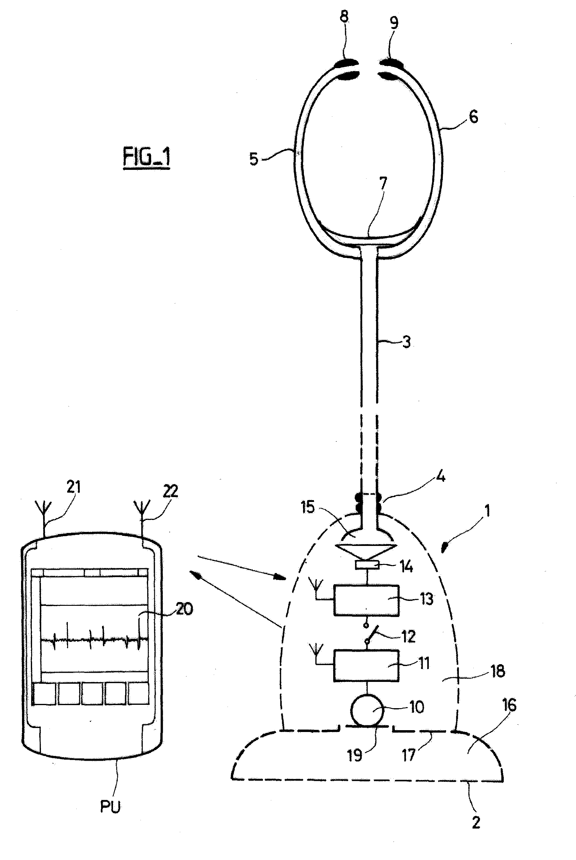 Electronic stethoscope