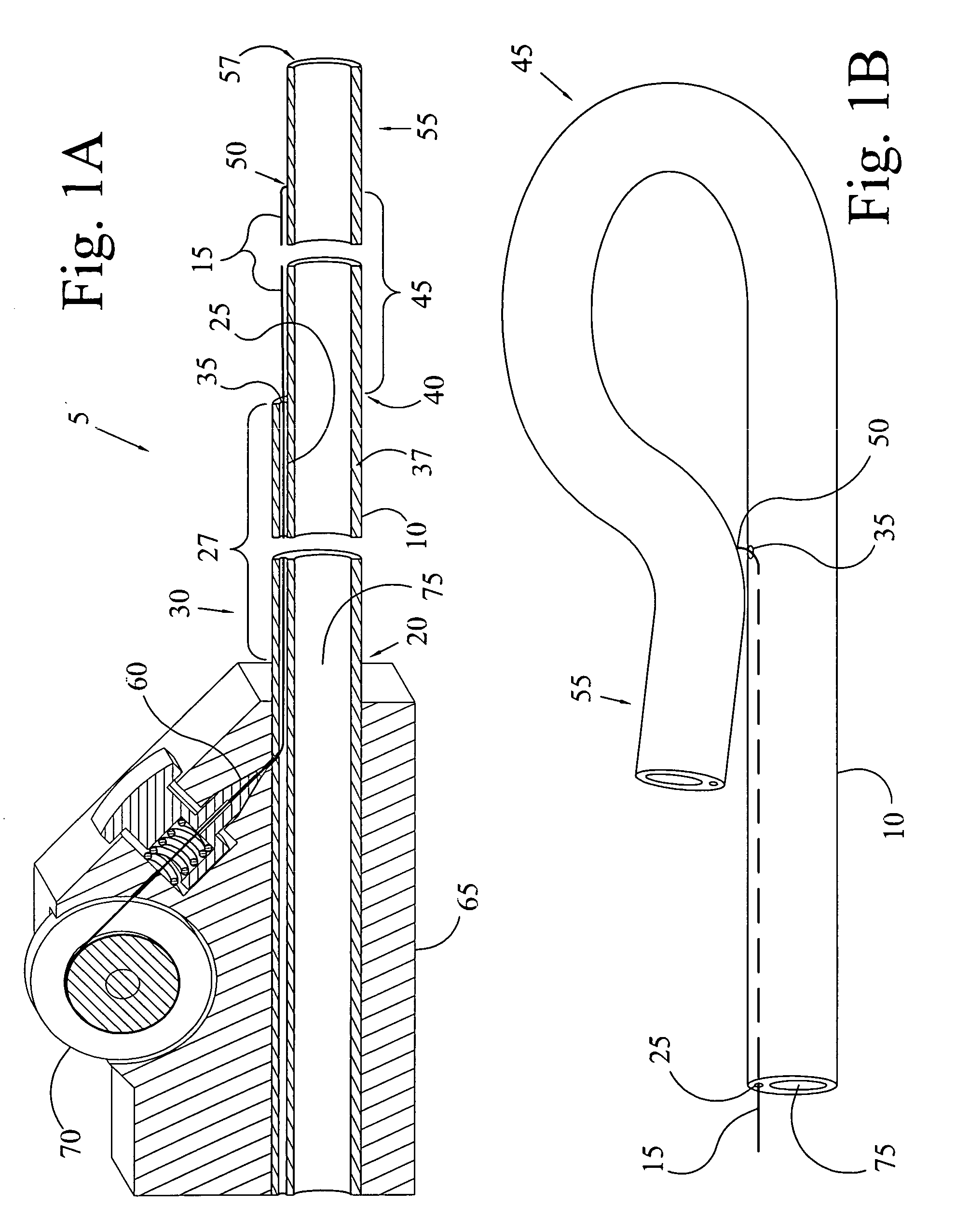 Closable loop access guide catheter