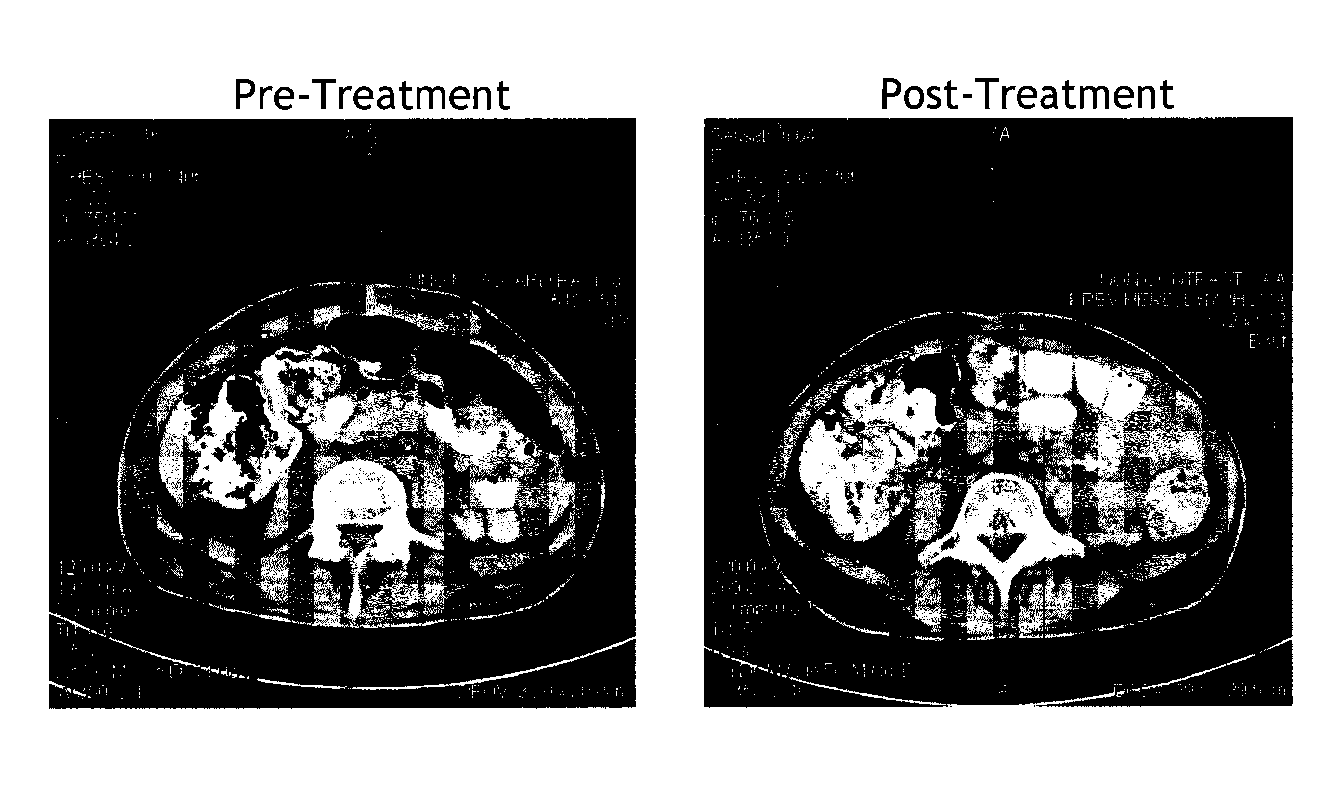 Methods for treating viral disorders