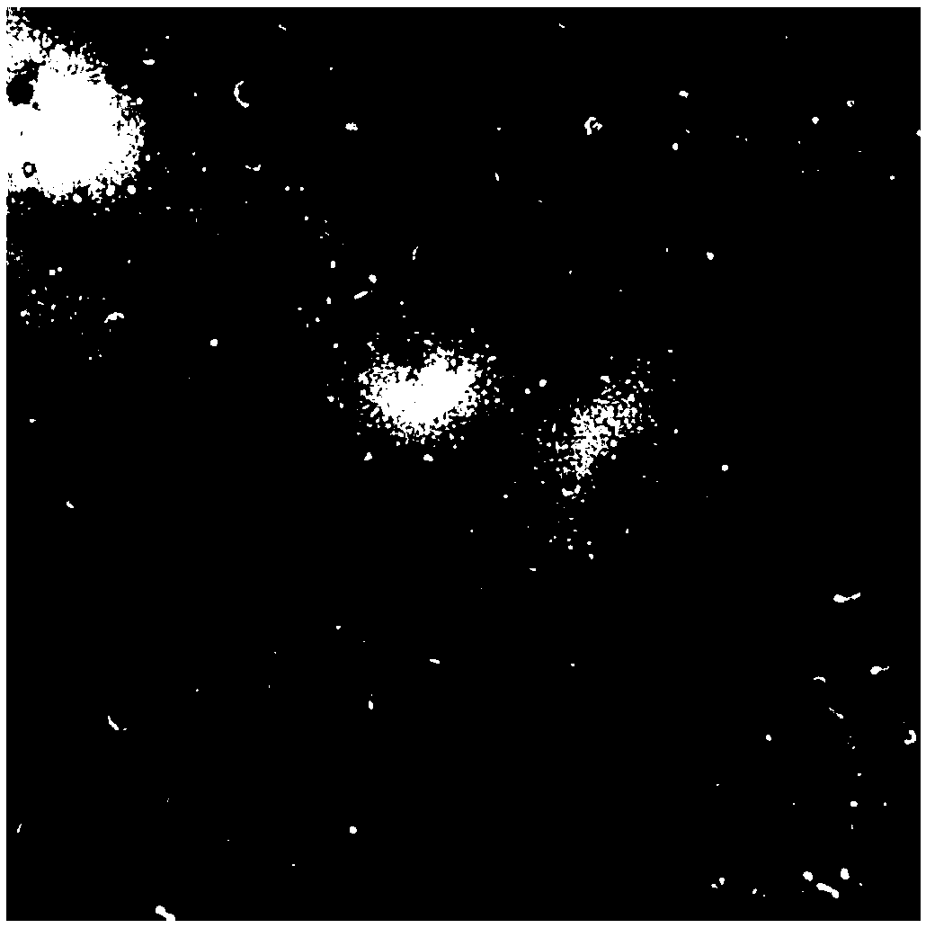 Application and preparation method of autologous fibroblast-sourced freeze-dried exosome powder