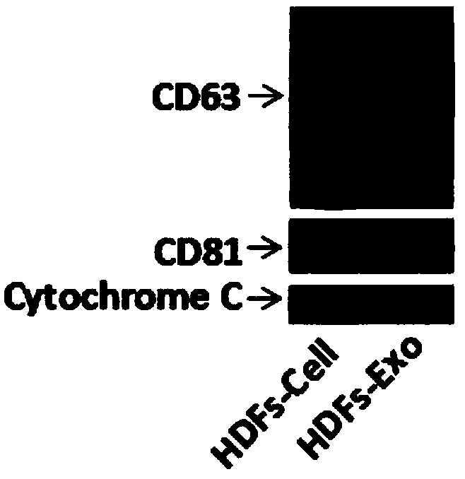 Application and preparation method of autologous fibroblast-sourced freeze-dried exosome powder