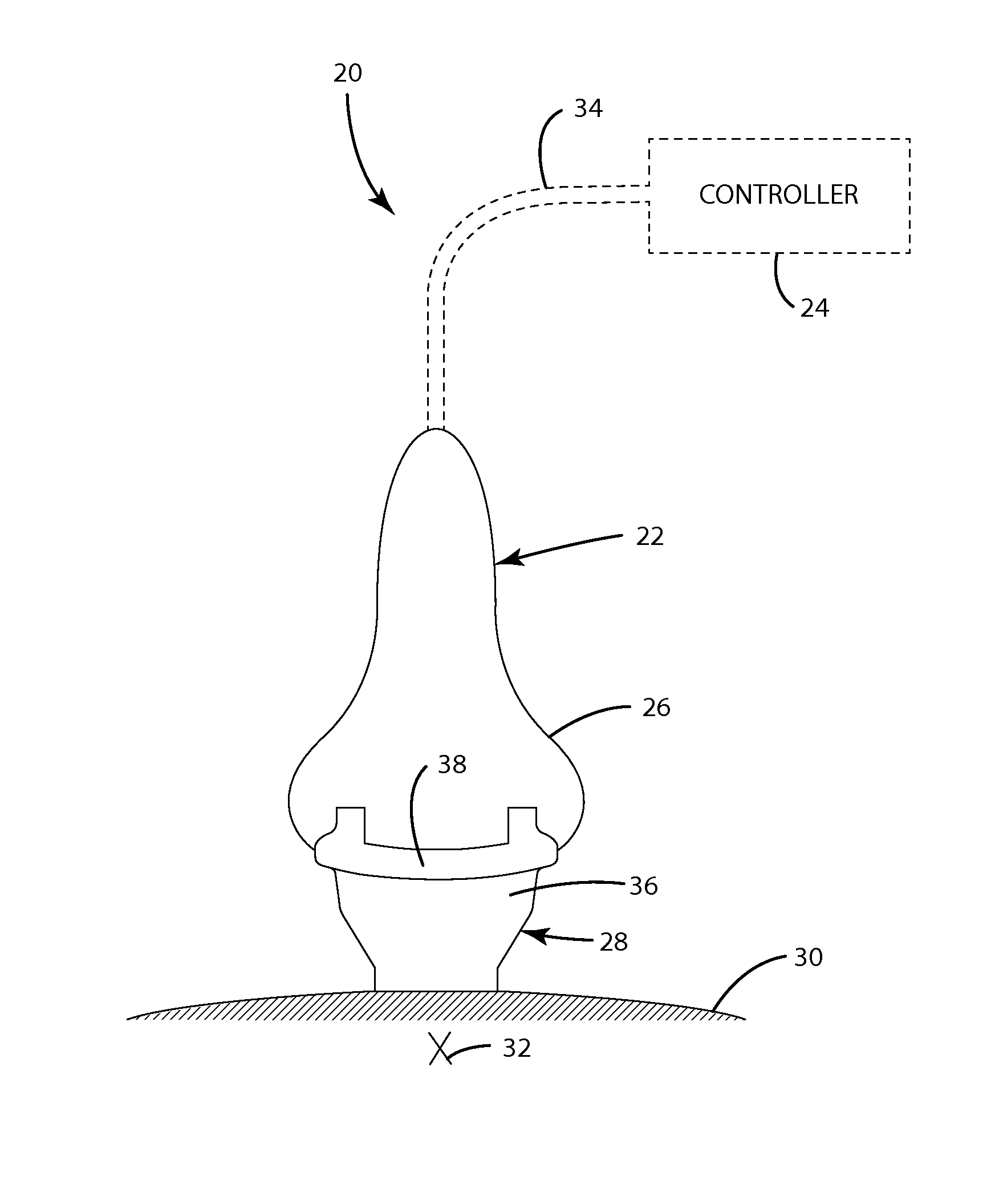 Ultrasonic head trap