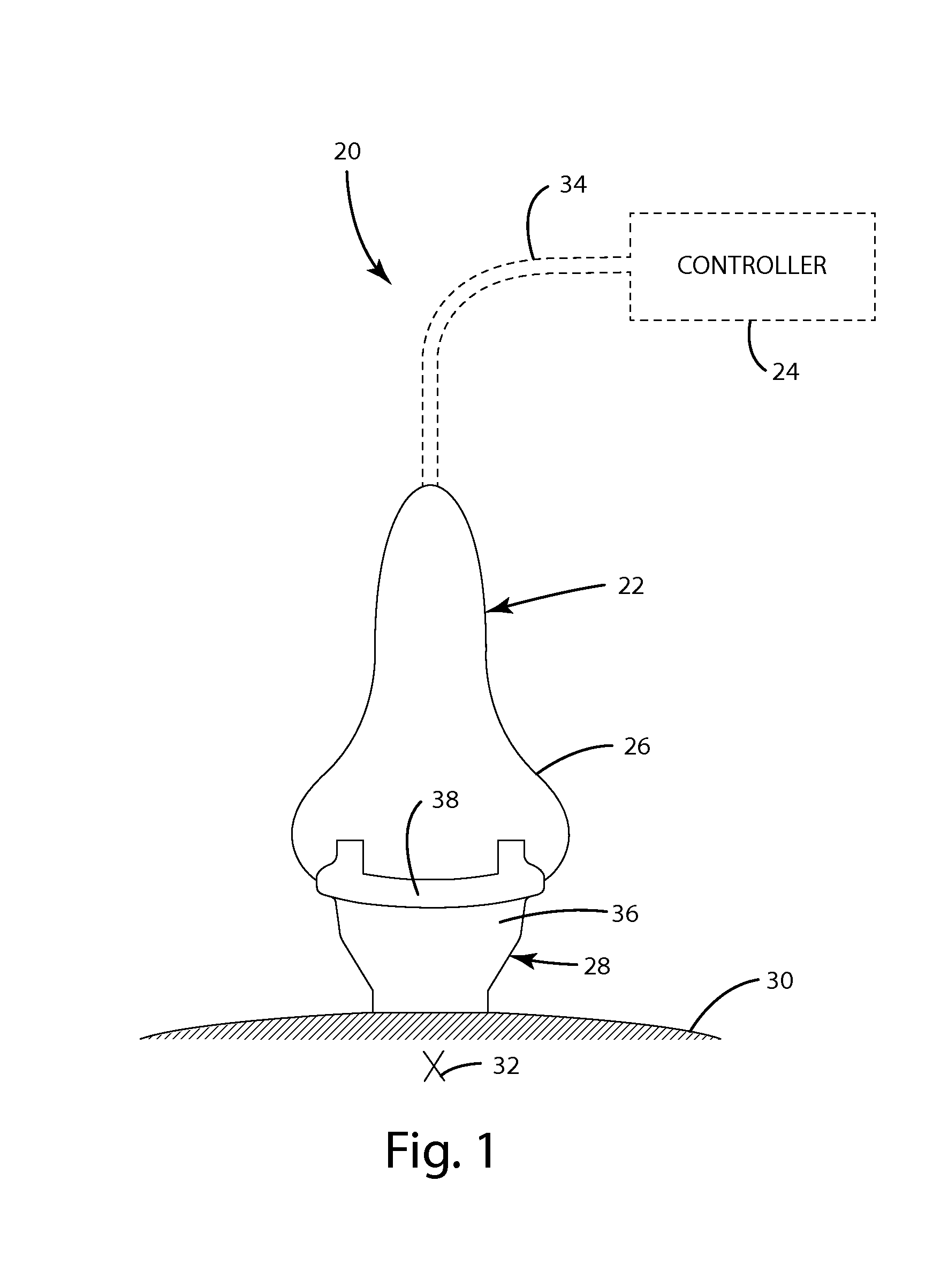 Ultrasonic head trap