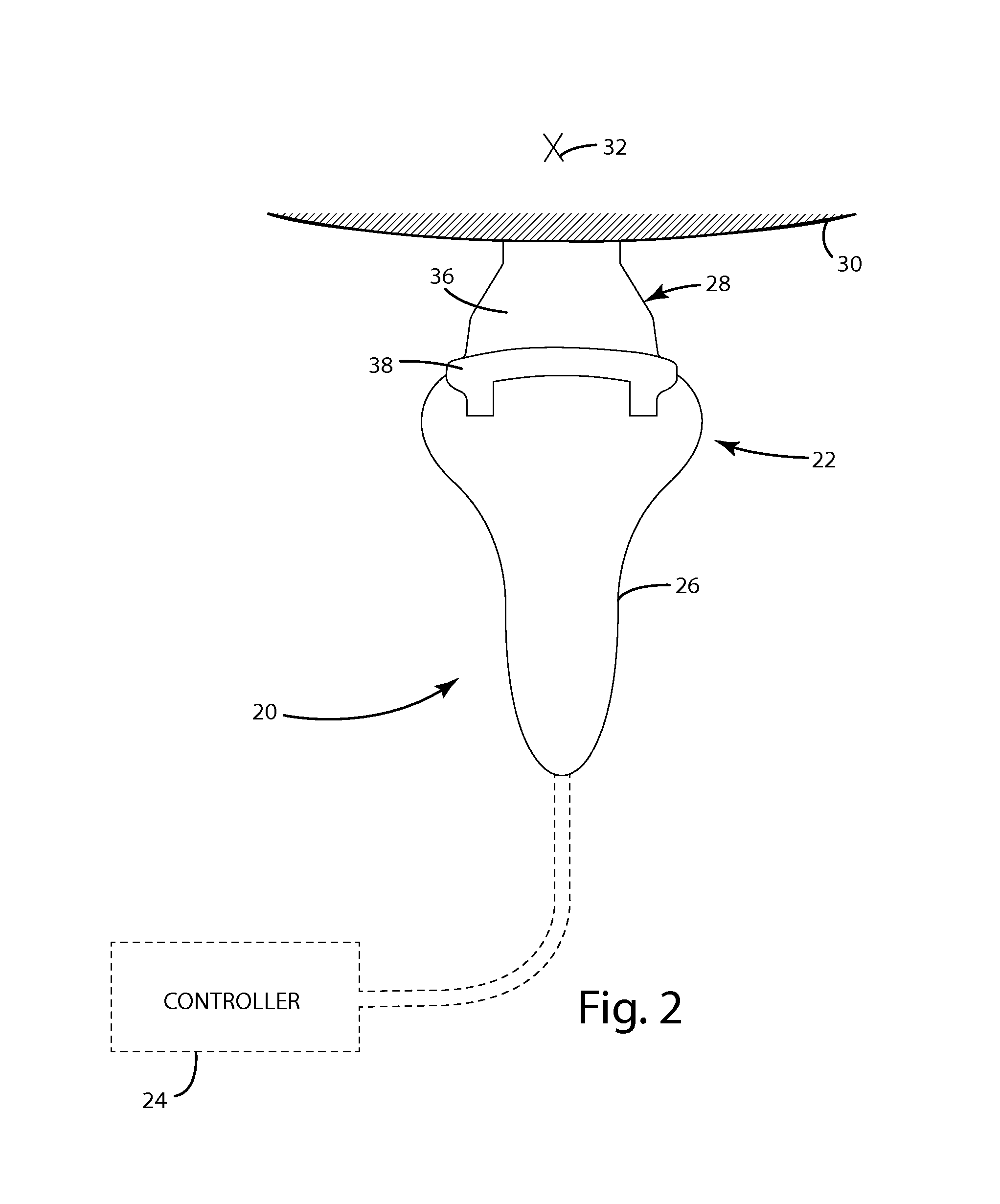 Ultrasonic head trap