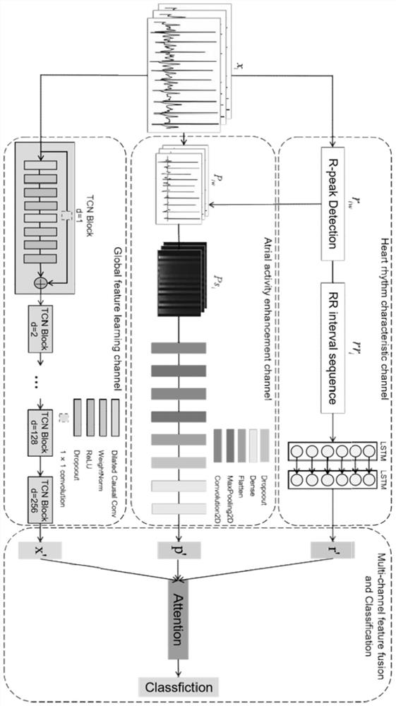 Electrocardiosignal classification method and system based on multi-domain feature learning