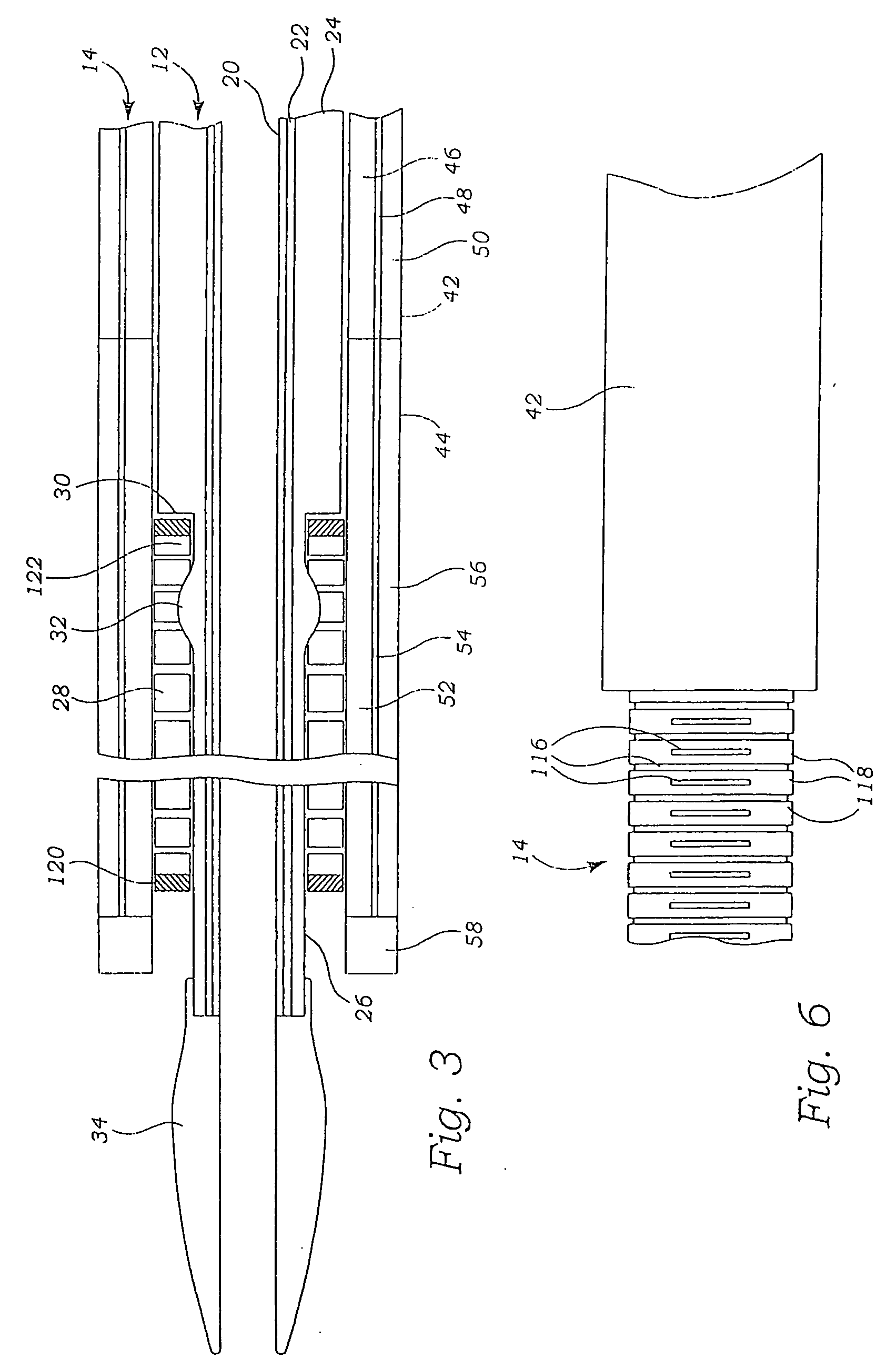 Stent delivery system