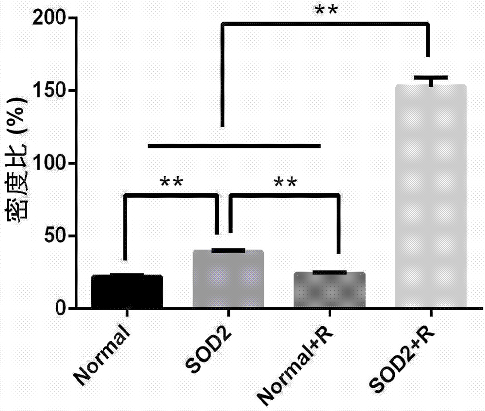 SOD2 lentiviral vector, construction method and application thereof in targeted radiation protection and tumor sensitization