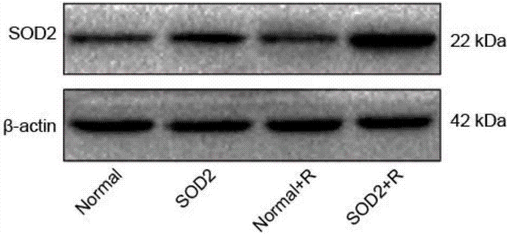 SOD2 lentiviral vector, construction method and application thereof in targeted radiation protection and tumor sensitization