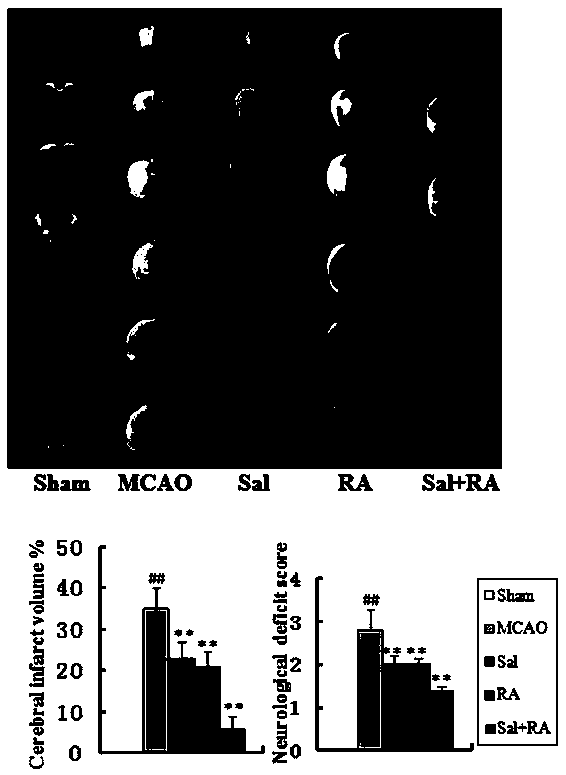 Pharmaceutical composition for reducing progressive stroke and brain injury by applying rosmarinic acid