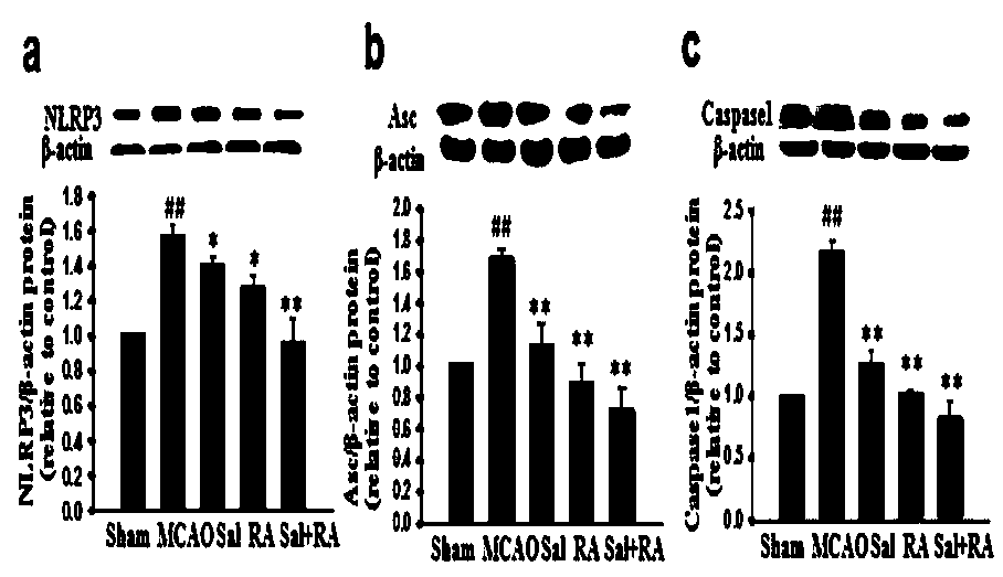 Pharmaceutical composition for reducing progressive stroke and brain injury by applying rosmarinic acid