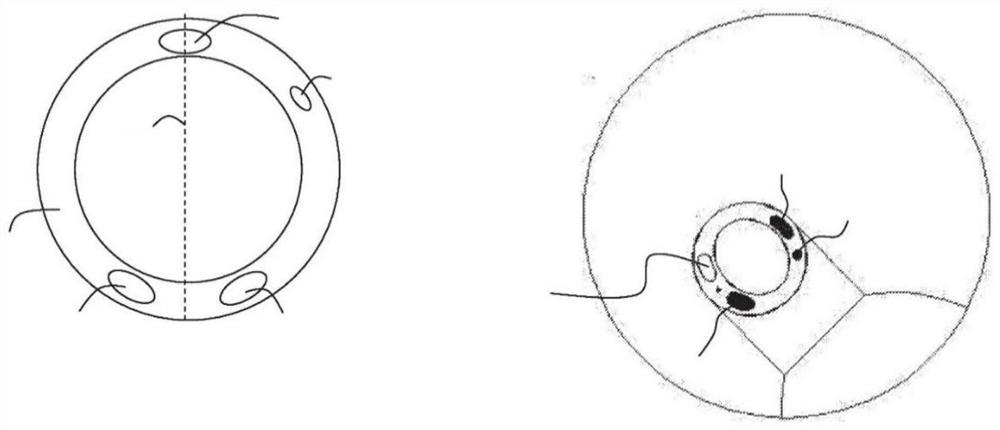 Multifunctional airway management system