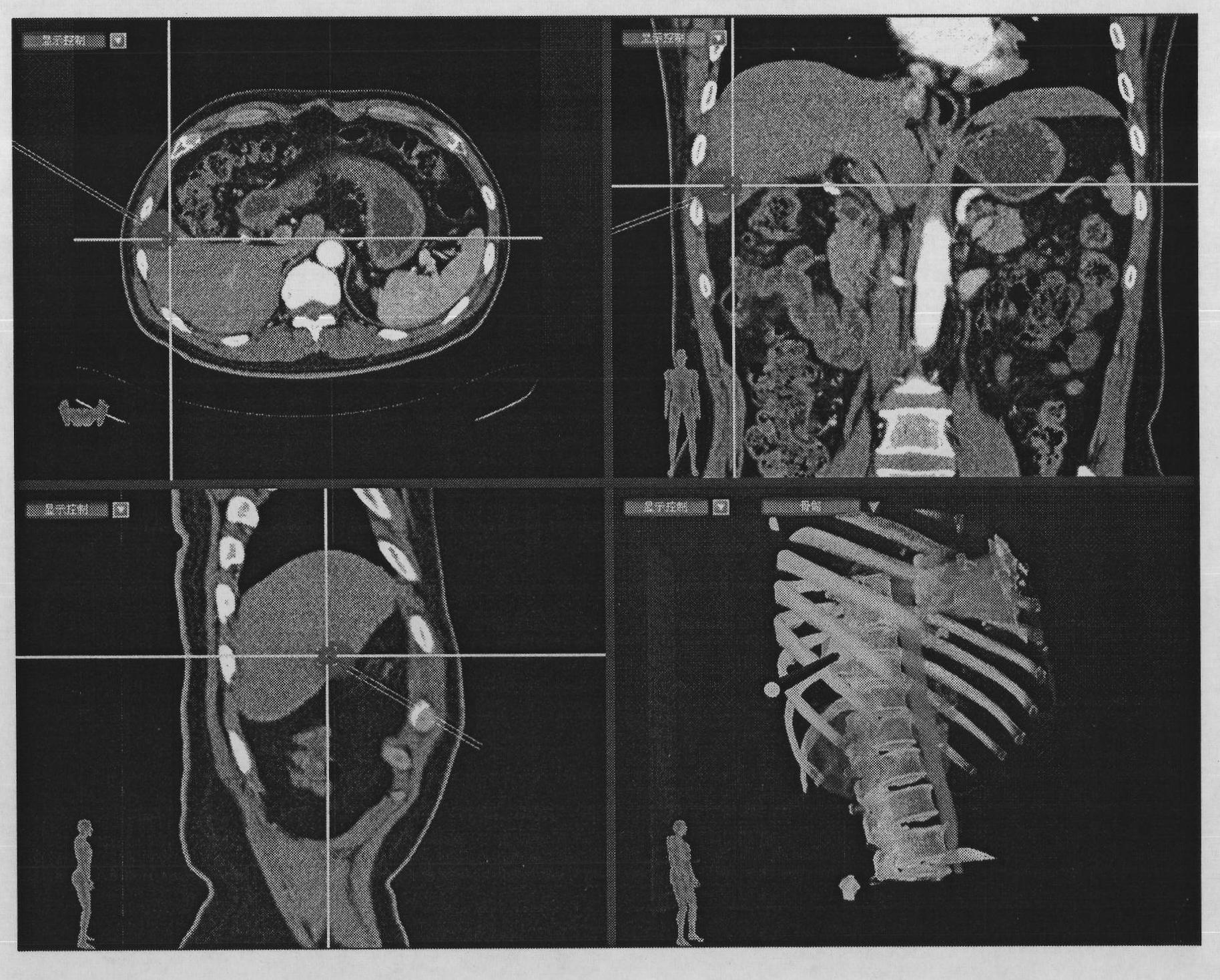 Image-guided ablation surgery planning device