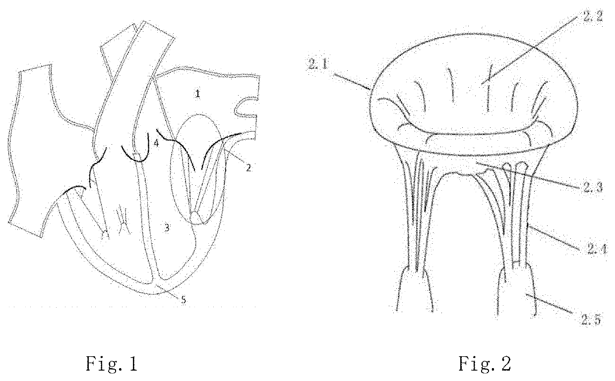 Device for treatment of valve regurgitation