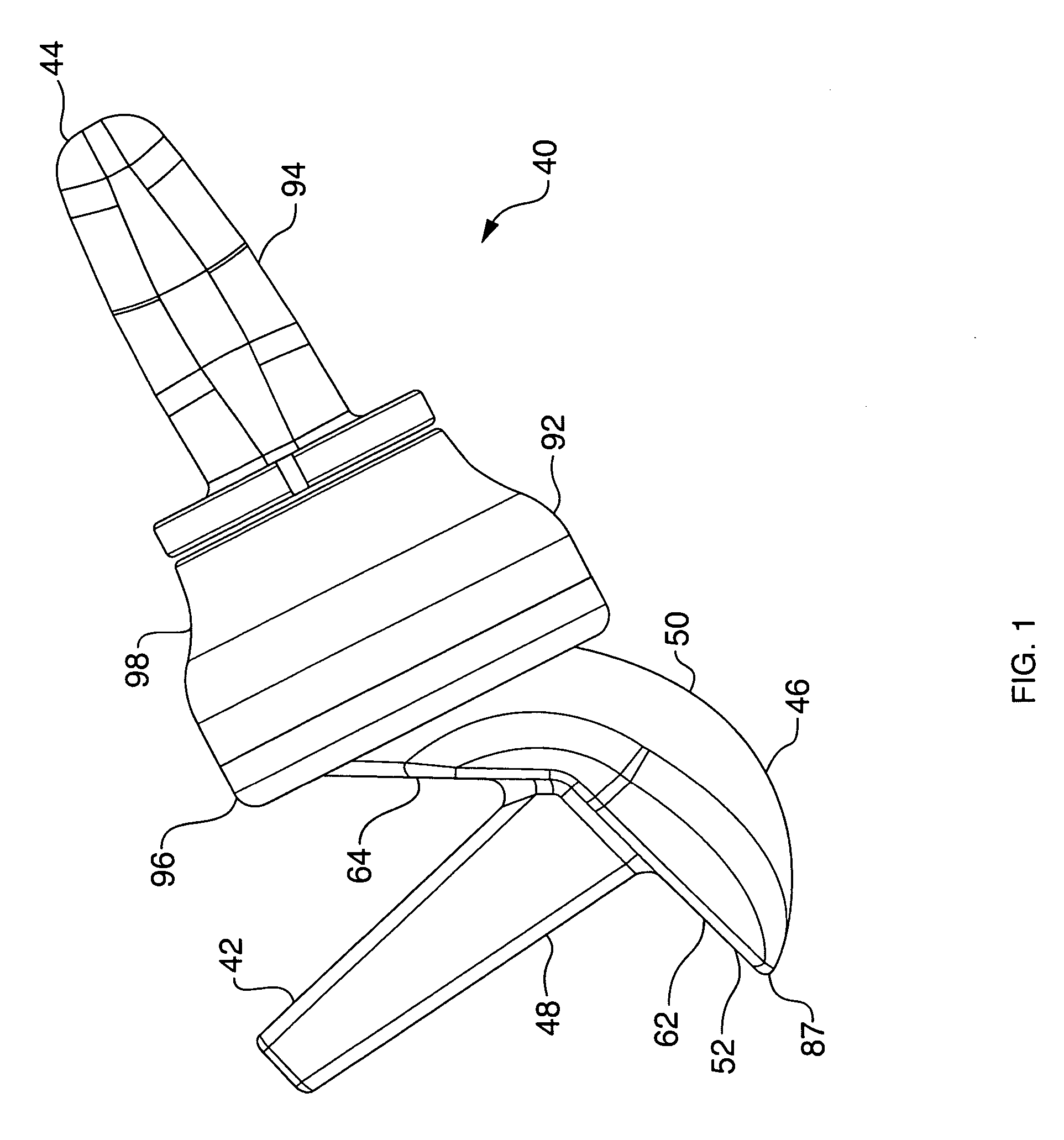 Radial-capitellar implant