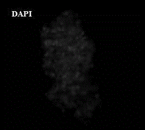 Immunofluorescence staining method for suspension cells