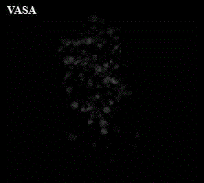 Immunofluorescence staining method for suspension cells