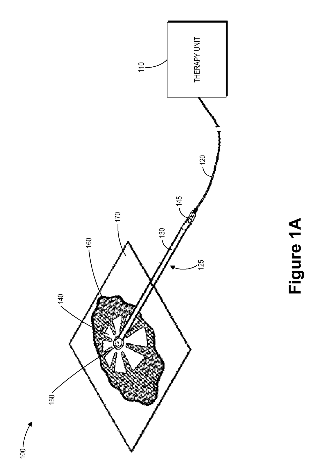 Fluidic connector for irrigation and aspiration of wounds