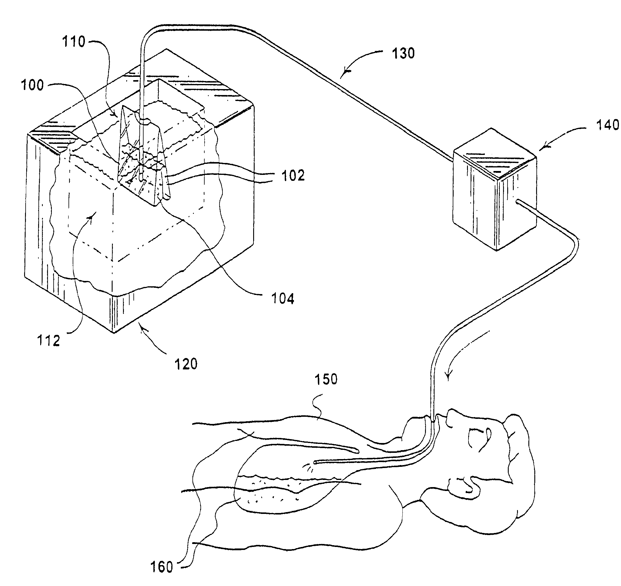 Method for inducing hypothermia