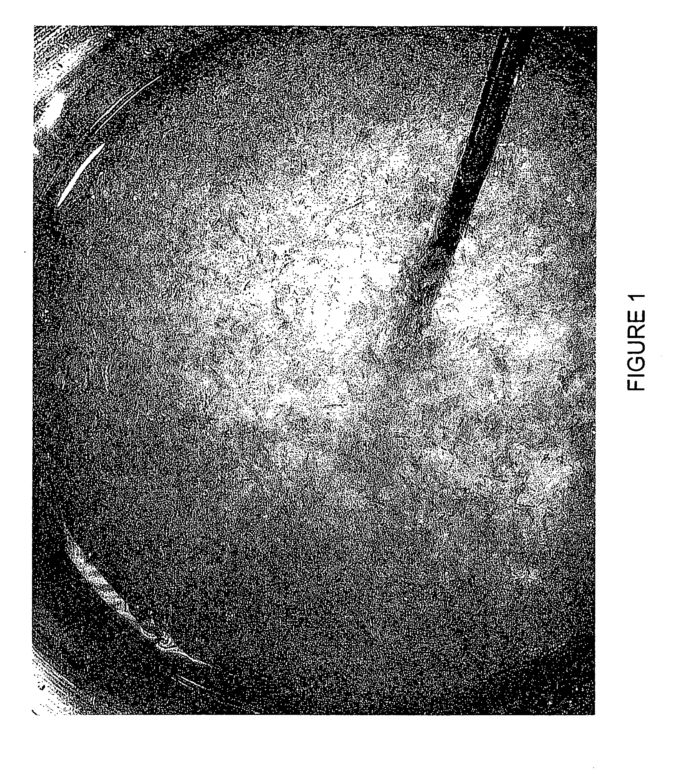 Method for inducing hypothermia