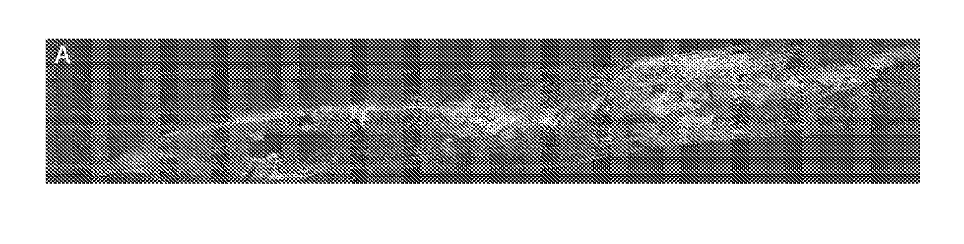 Methods for delivery of sirna to the spinal cord and therapies arising therefrom