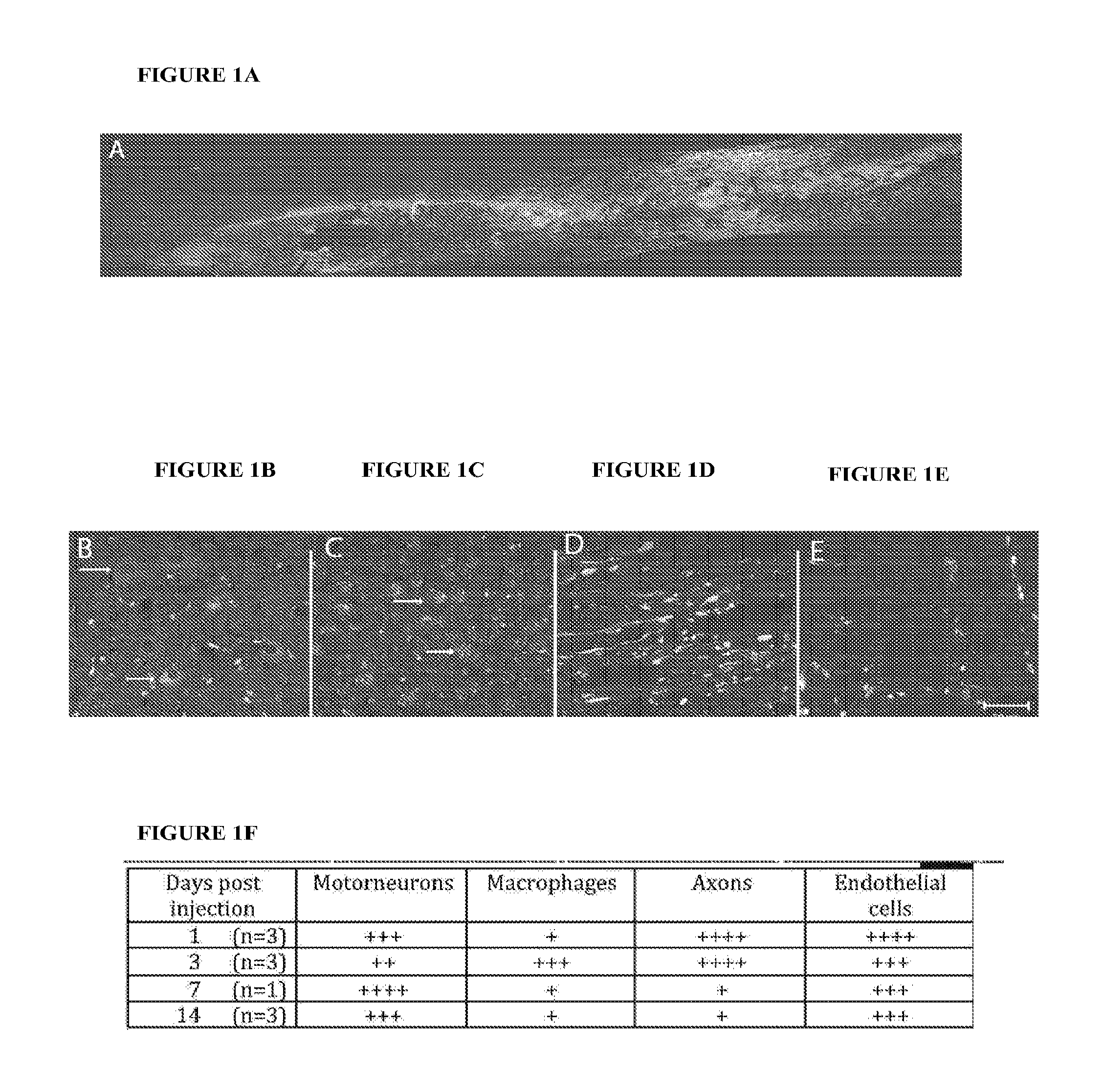 Methods for delivery of sirna to the spinal cord and therapies arising therefrom